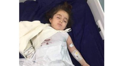 دب يهاجم طفلة في العراق ويكاد يبهر ذراعها